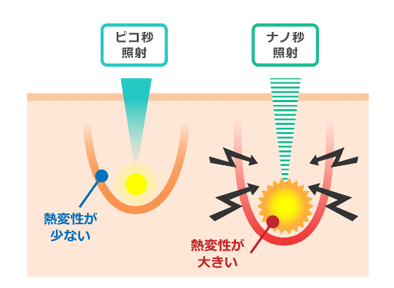 ナノ秒照射は熱変性が大きい。ピコ秒照射は熱変性が少ない。